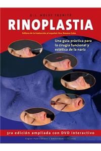 Rinoplastia