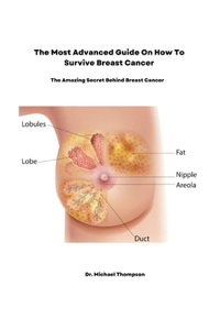 most advanced guide on how to survive breast cancer