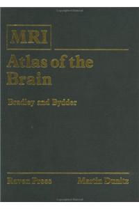 MRI Atlas of the Brain