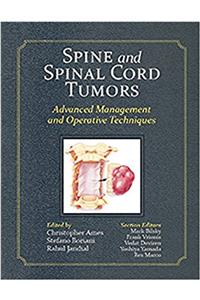 Spine and Spinal Cord Tumors