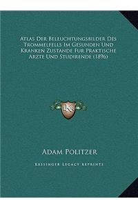 Atlas Der Beleuchtungsbilder Des Trommelfells Im Gesunden Und Kranken Zustande Fur Praktische Arzte Und Studirende (1896)