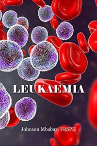 Leukaemia