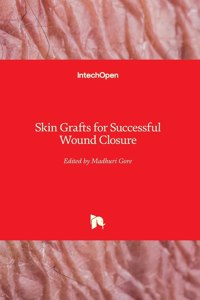 Skin Grafts for Successful Wound Closure