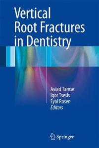 Vertical Root Fractures in Dentistry