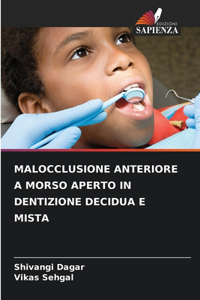 Malocclusione Anteriore a Morso Aperto in Dentizione Decidua E Mista