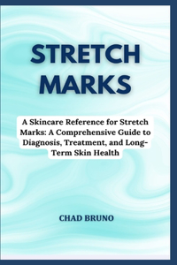 Stretch Marks