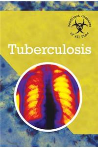 Tuberculosis