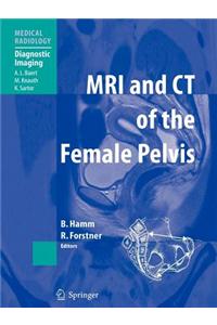 MRI and CT of the Female Pelvis