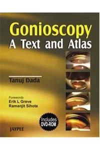 Gonioscopy: A Text and Atlas with DVD-ROM