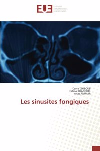 Les sinusites fongiques