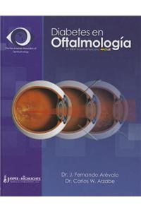 Diabetes en Oftalmologia