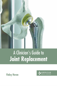 Clinician's Guide to Joint Replacement