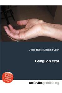 Ganglion Cyst