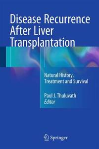 Disease Recurrence After Liver Transplantation