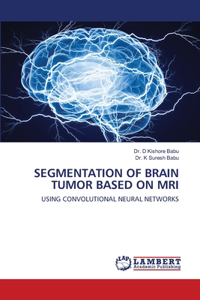 Segmentation of Brain Tumor Based on MRI