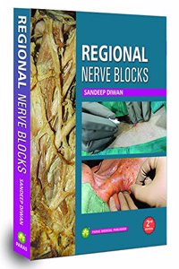 Regional Nerve Blocks