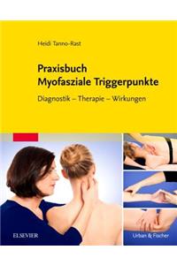Praxisbuch Myofasziale Triggerpunkte