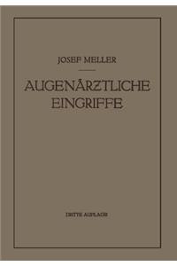 Augenärztliche Eingriffe