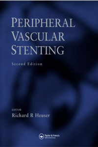 Peripheral Vascular Stenting, Second Edition