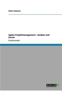 Agiles Projektmanagement - Kanban und Scrum