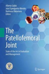 Patellofemoral Joint
