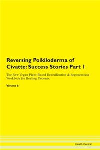 Reversing Poikiloderma of Civatte: Succe