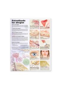 Understanding Allergies Anatomical Chart in Spanish (Entendiendo Las Alergias)