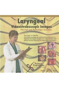 Laryngeal Videostroboscopic Images