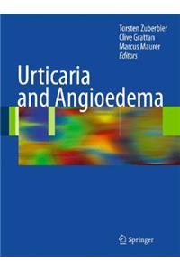 Urticaria and Angioedema