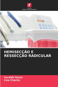 Hemisecção E Ressecção Radicular