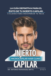 La Guía Definitiva Para El Éxito de Tu Injerto Capilar