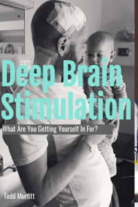 Deep Brain Stimulation - What are you getting yourself in for?