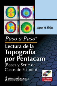 Paso a Paso - Lectura de la Topografia por Pentacam