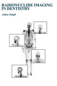 Radionuclide Imaging in Dentistry