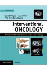 Interventional Oncology