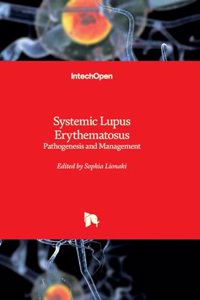 Systemic Lupus Erythematosus - Pathogenesis and Management