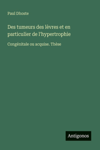 Des tumeurs des lèvres et en particulier de l'hypertrophie