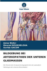 Bildgebung Bei Arteriopathien Der Unteren Gliedmassen