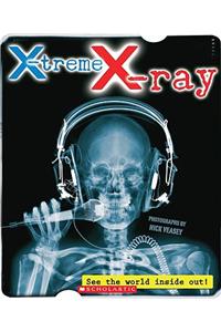 X-Treme X-Ray
