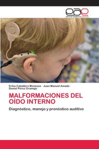 Malformaciones del Oído Interno