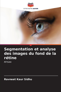 Segmentation et analyse des images du fond de la rétine