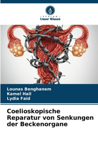 Coelioskopische Reparatur von Senkungen der Beckenorgane