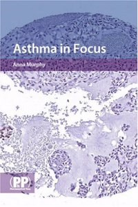 Asthma in Focus