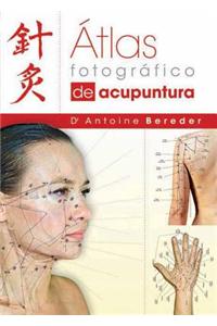 Atlas Fotografico de Acupuntura