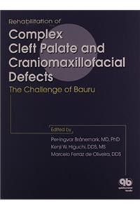Rehabilitation of Complex Cleft Palate and Craniomaxiliofacial Effects: The Challenge of Bauru