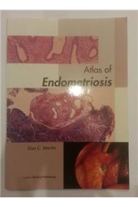 Atlas of Endometriosis