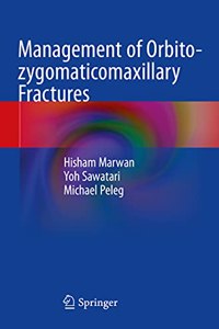 Management of Orbito-Zygomaticomaxillary Fractures
