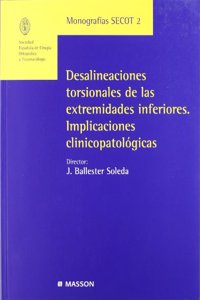 Desalineaciones torsionales de las extremidades inferiores