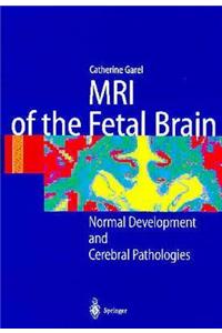 MRI of the Fetal Brain