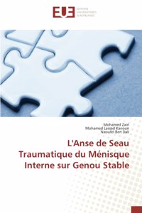 L'Anse de Seau Traumatique du Ménisque Interne sur Genou Stable